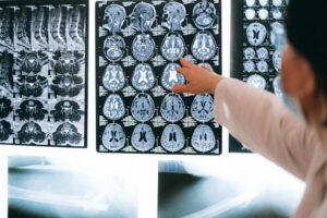 Brain scans being pointed to by a radiologist, suggesting uncovering hidden things.